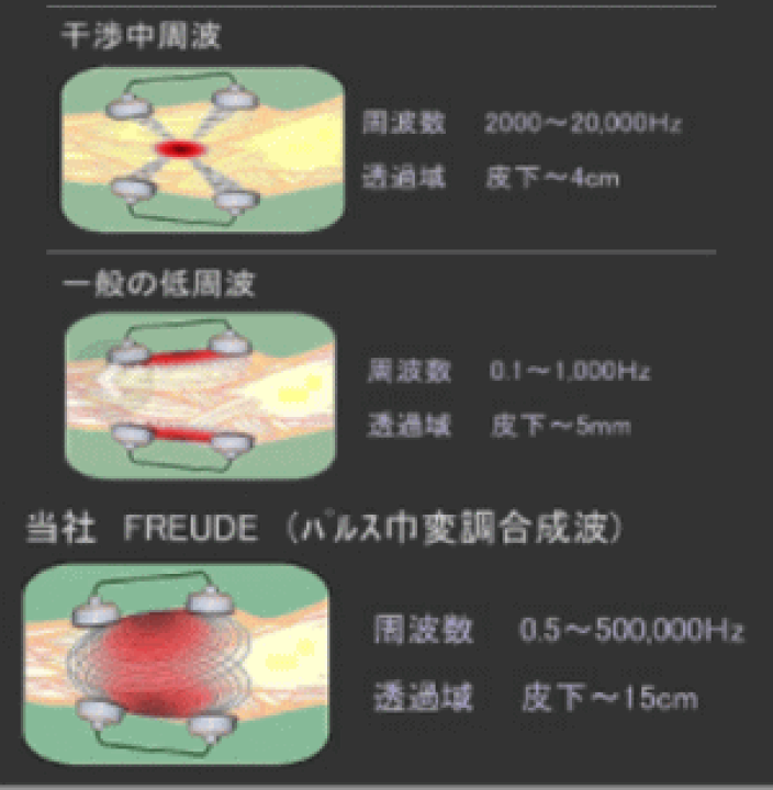 送料無料 (株)テクノリード フロイデ 本体 業務用 50万Hz 4De NFD-4×1台 出力口4個 複合高周波ems機器 インナーマッスル EMS  筋力トレ−ニング ロコモ 関節 美顔 足 腹筋 ダイエット器具 | キリン堂通販SHOP