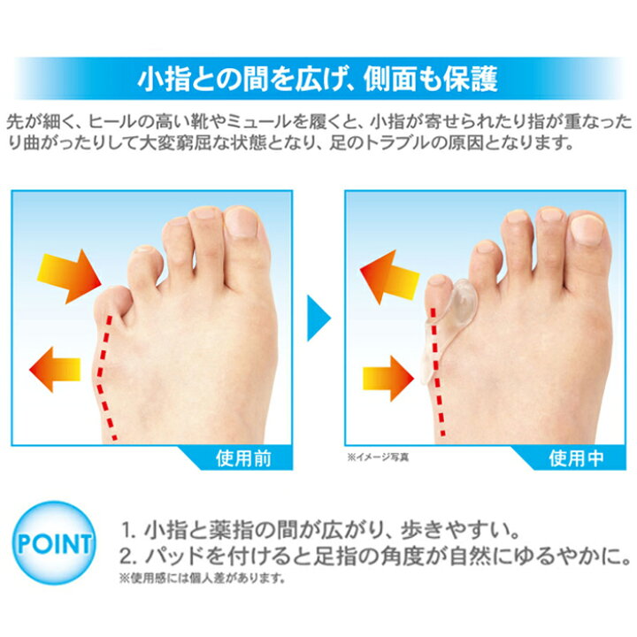 128円 宅配便配送 内反小趾楽歩 フットケア用品