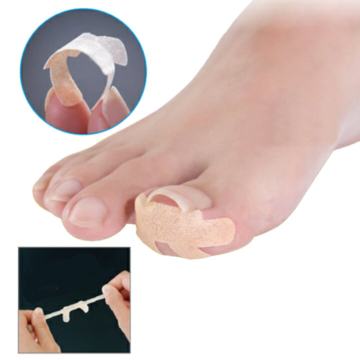 楽天市場 形状記憶 巻き爪 対策 親指 テーピング 貼り付け 簡単 保護プレート 35 1000円 送料無料 となりの雑貨屋さん