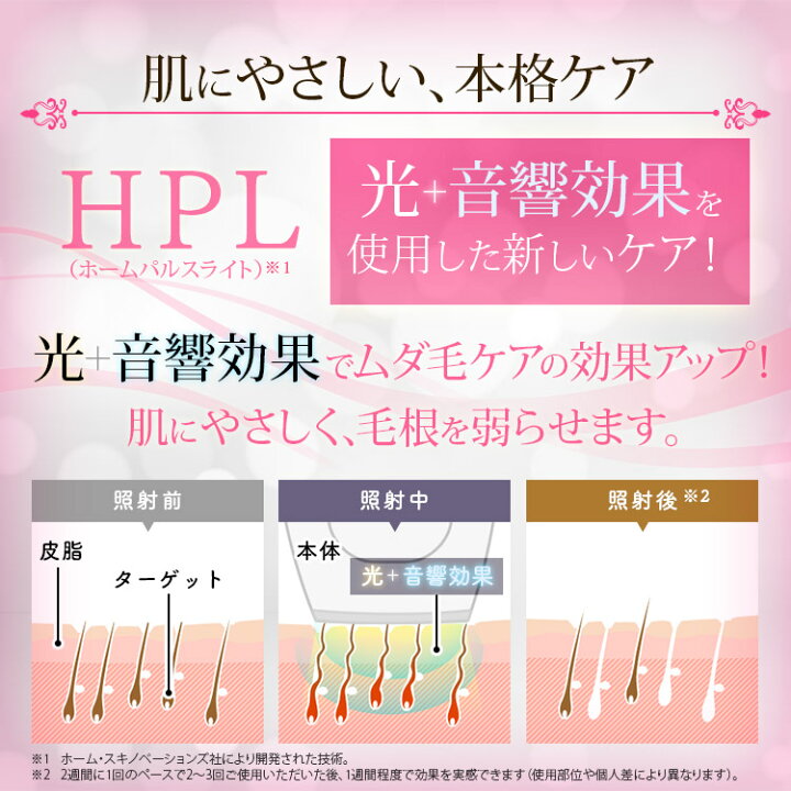 楽天市場 ポイント5倍 4日正午 24時 先着クーポンで400円off 10 6 10時迄 脱毛機 ホームパルスライト式 光美容器 エピレタモーション Ep 0337 P送料無料 脱毛機 エピレタ モーション プロ 脱毛 光脱毛 脱毛器 除毛 ムダ毛 美肌 美容 アイリスオーヤマ 家具インテリア館
