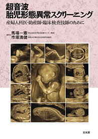 【中古】超音波胎児形態異常スクリーニング: 産婦人科医・助産師・臨床検査技師のために
