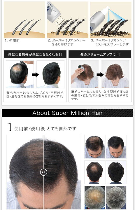 楽天市場】スーパーミリオンヘアー 30g（ブラックorダークブラウン）TV 