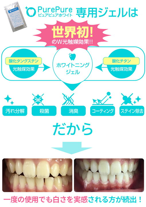 楽天市場】＼楽天1位／ 60W セルフホワイトニング 業務用 開業 セット 