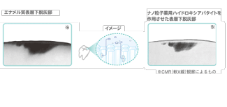 効果説明03