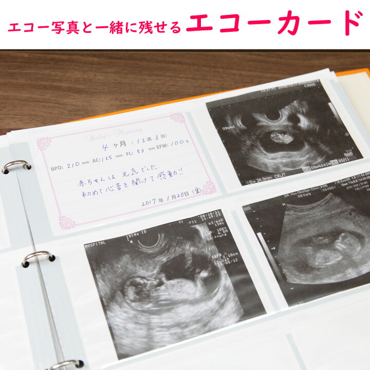 楽天市場 エコーカード 写真アルバム用エコーアルバム作りに コメント書き込み用の育児カードです大容量リング式ポケットアルバム専用ですおなかの中の赤ちゃん成長記録 ベビーから結婚式のアルバム屋さん