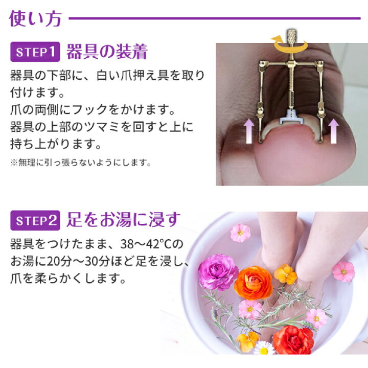 楽天市場 巻き爪 矯正 サポート 器具 ケース付き ネイルケア ツール 陥入爪 ネイル セルフケア 矯正 グッズ ポスト投函 送料無料 健康ｆａｎ 楽天市場店