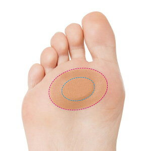 y䂤pPbgzIzȒP\邾 NbVt܂߃K[he[v(|Xg ǐՂ胁[)