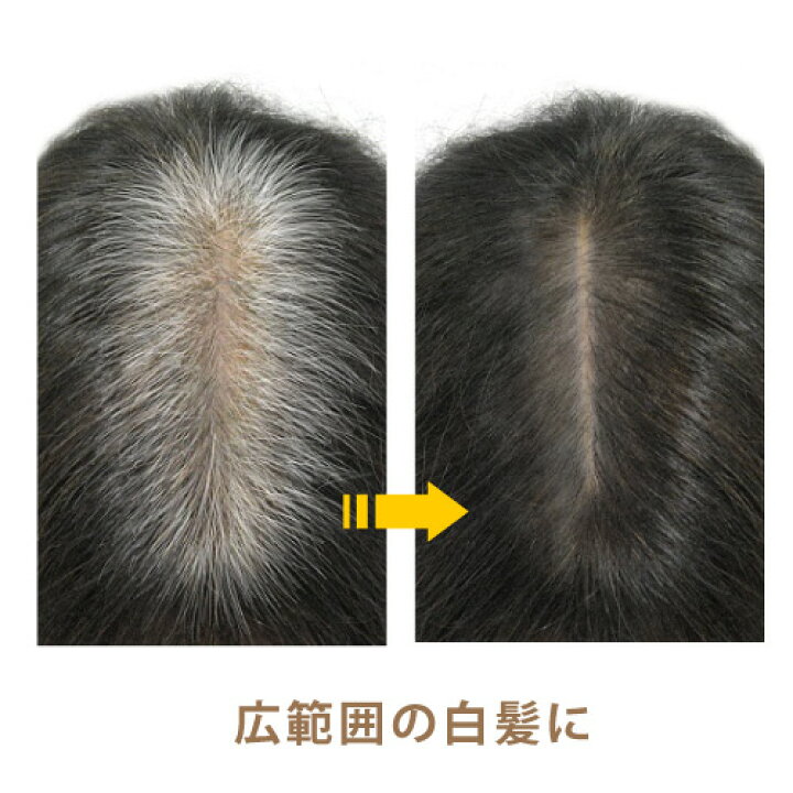 楽天市場 グリーンノート ヘアカラーファンデーション 3色 ライトブラウン ダークブラウン ブラック 12g 広範囲の白髪 地肌用 生え際や根元の白髪を隠す リタッチ ノンシリコン 石油系成分不使用 送料無料 定形外発送 健康生活をサポートするケントク