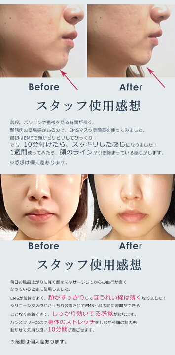 楽天市場】NEWタイプ 美顔器 ems ギフト対応 リフトアップ 小顔 目元 