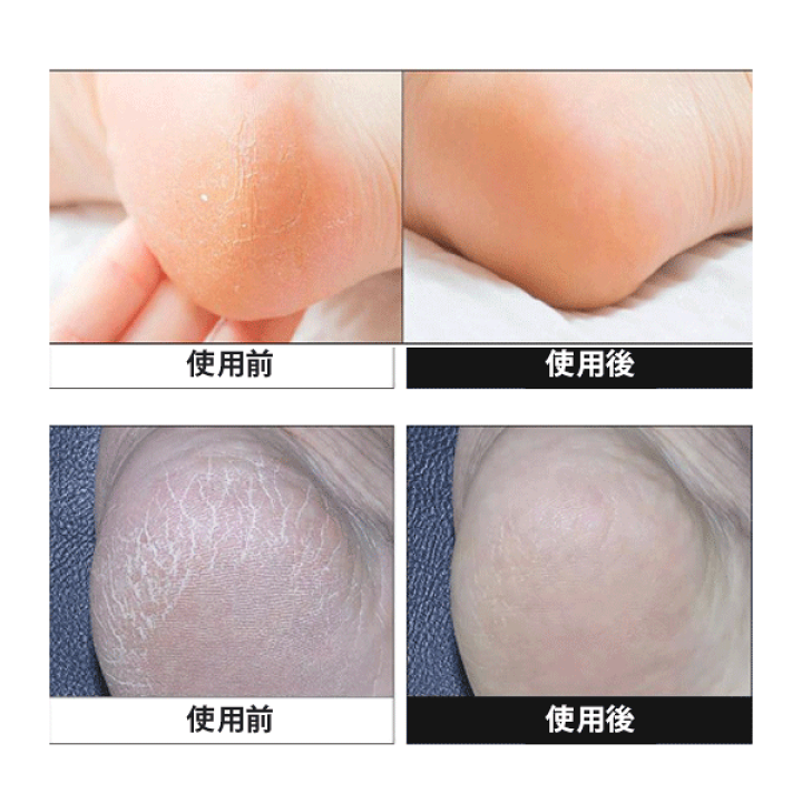 楽天市場】MEDI‑PEEL メディピール EGF スケーリングモイスチャー