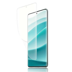 �y�A���`�O���A 1���Z�b�g�zRedmi Note 14 Pro 5G �p �t�B���� ���b�h�~�[ Note 14 Pro 5G ��p �A���`