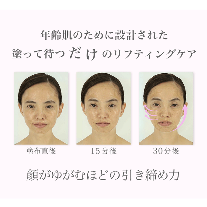 楽天市場】30%OFF リフトアップ シワ ほうれい線 たるみ くすみ
