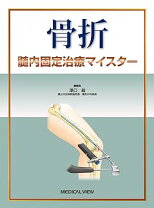 楽天市場】骨折髄内固定治療マイスターの通販