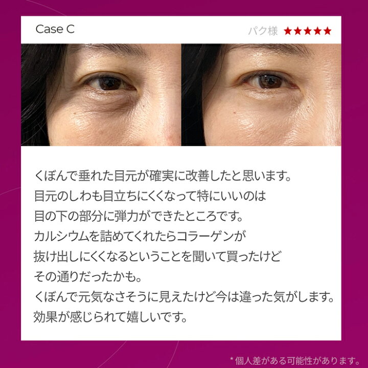 楽天市場】【 Dr.Melaxin 正規品 】【 ドクターメラクチン セメンリト 