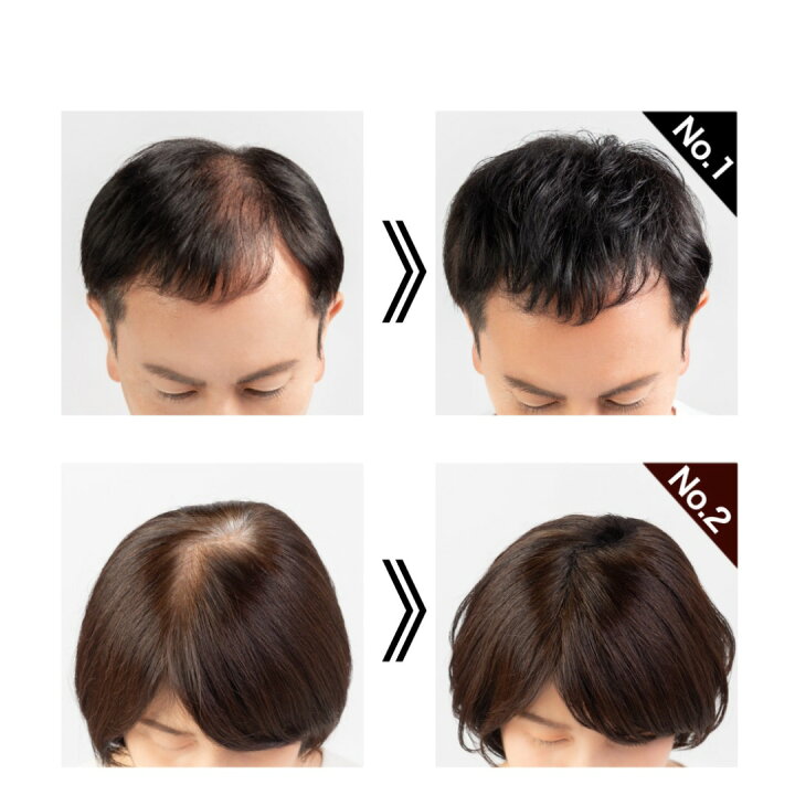 スーパーミリオンヘアー ダークブラウン 30g 6箱 新品・未開封 【公式 