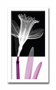 uStem1vyX-ray PhotographzSteven N.MeyersiGbNXC@tHgOt@CeAA[gt[jmGʔ́nyĜ炵zyǊ|tbNz