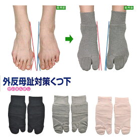 外反母趾対策くつ下‐蘭華 コーポレーションパールスター 広島大学 外反母趾 予防 対策 矯正 くつ下 パット 綿 就寝時 長時間着用