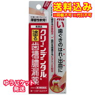 ゆうパケット）【第3類医薬品】クリーンデンタルN　歯槽膿漏薬　16g