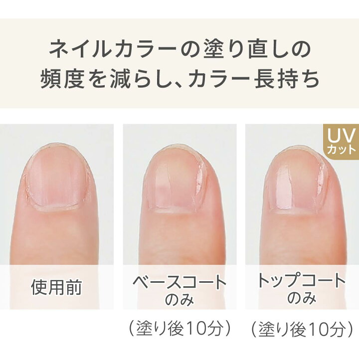 楽天市場】P5倍◇ ZOYA ベース&トップコート | 医療用 爪保護 