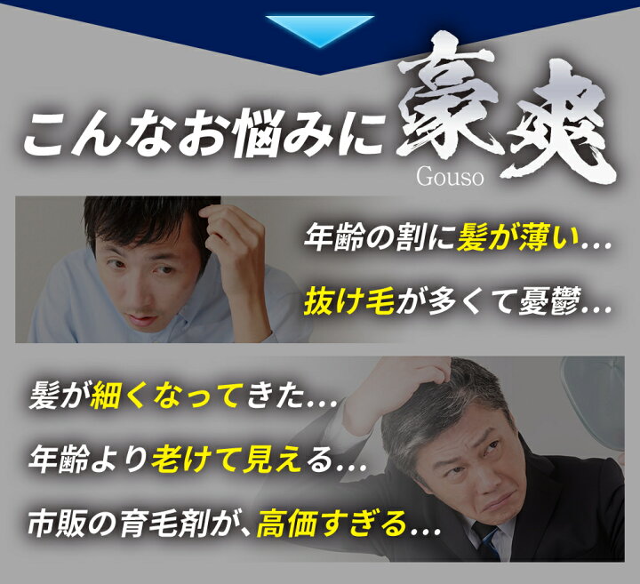 楽天市場 美容師推奨 育毛剤 豪爽 薬用育毛剤 育毛トニック 発毛剤 スカルプ 育毛 薄毛 男性用 女性用 発毛促進 養毛 抜け毛対策 ヘアケアソムリエ美容師 育毛マッサージ マニュアル付 発毛剤 ではなく育毛剤 150ｍｌ 医薬部外品 La Idea