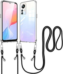 NA Blackview A85 P[X V_[ Blackview A85 X}zP[X Xgbvt ϏՌ Jo[ TPU | ΂߂ |P[X | ^ y \ O\ h~ h