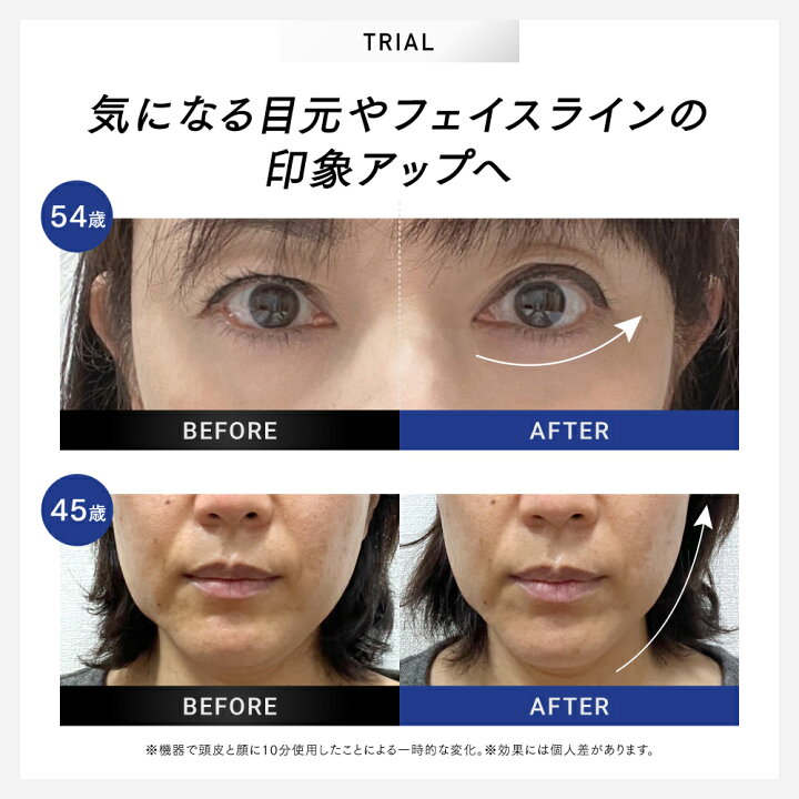 楽天市場】EMS 美顔器 ＼7/4 20時～先着100名 40%OFFクーポンで29,700
