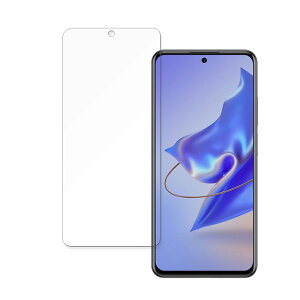 ZTE Voyage 30 Pro+ ������ �ی�t�B���� �y�ȖʑΉ� ����d�l�z �u���[���C�g�J�b�g�t�B���� �L�Y�C�� ���{��