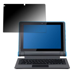 360x `h~tB mouse MousePro-P101A-IOTS-LT ̃tB u[CgJbg {