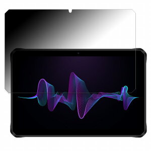 180x `h~ tB DOOGEE R10  یtB ȖʑΉ u[CgJbg y˒ጸz {