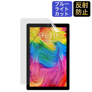 CHUWI HiPad X �p �ی�t�B���� �u���[���C�g�J�b�g �t�B���� ���˒ጸ