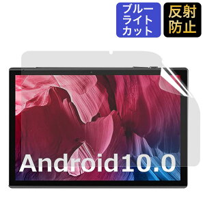 MARVUE Pad M10 ^ubg 10.1C`p یtB u[CgJbg tB ˒ጸ