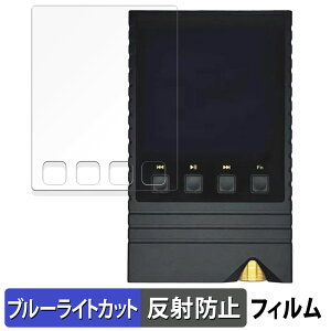 s|Cg2{t ONIX Overture XM5  یtB u[CgJbg tB y˒ጸz {