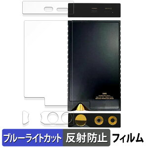 ONIX Overture XM5 ( w /  /  )  یtB u[CgJbg tB y˒ጸz {