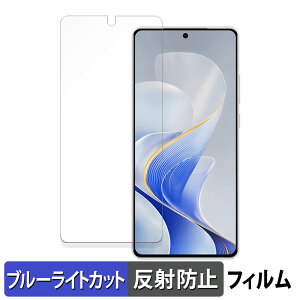 vivo S19  یtB u[CgJbg tB y˒ጸz {