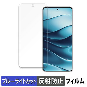 Xiaomi Redmi Note 14 5G  یtB u[CgJbg tB y˒ጸz {