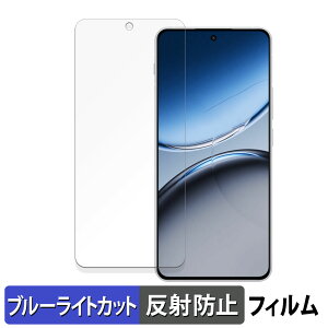 �y�|�C���g2�{�z OnePlus Nord 4 ������ �ی�t�B���� �u���[���C�g�J�b�g �t�B���� �y���˒ጸ�z ���{��