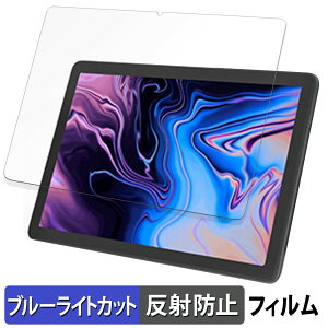 kinstone 102SF LbY^ubg 10.1C`  یtB u[CgJbg tB y˒ጸz {