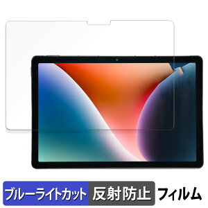 AGM PAD P2 ������ �ی�t�B���� �u���[���C�g�J�b�g �t�B���� �y���˒ጸ�z ���{��