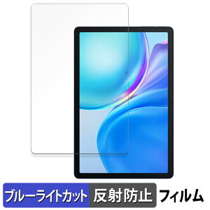 Blackview Tab 90 WiFi ������ �ی�t�B���� �u���[���C�g�J�b�g �t�B���� �y���˒ጸ�z ���{��