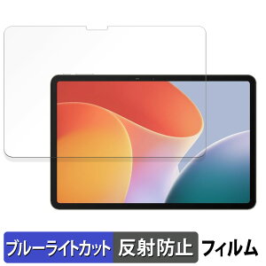 �y8/11 1:59�� �|�C���g2�{�z Infinix XPAD ������ �ی�t�B���� �u���[���C�g�J�b�g �t�B���� �y���˒ጸ�z ���{��
