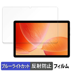 AvidPad A90S  یtB u[CgJbg tB y˒ጸz {