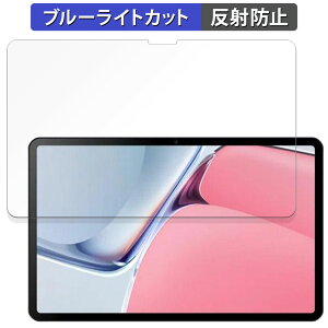 �y�y�V�X�[�p�[SALE �|�C���g2�{�z DOOGEE T20 Ultra ������ �ی�t�B���� �u���[���C�g�J�b�g �t�B���� �y���˒ጸ�z ���{��