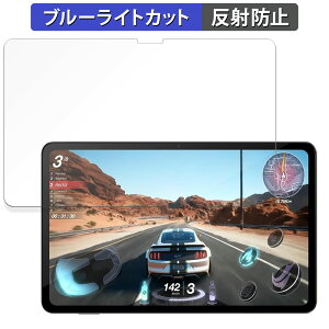 AvidPad A90  یtB u[CgJbg tB y˒ጸz {