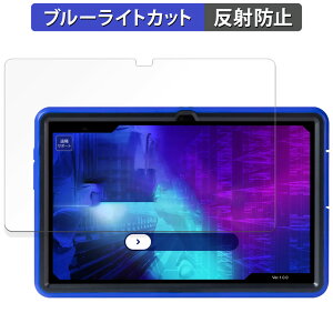 ���N�� ���q��Pad DX KP13-NV ������ �ی�t�B���� �u���[���C�g�J�b�g �t�B���� �y���˒ጸ�z ���{��