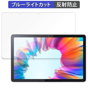 Lenovo Tab M10a 5G LET02 ������ �ی�t�B���� �u���[���C�g�J�b�g �t�B���� �y���˒ጸ�z ���{��