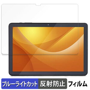 y|Cg2{z ACXI[} LUCA Tablet 10C` TE104M4V1-B  یtB u[CgJbg tB y˒ጸz {