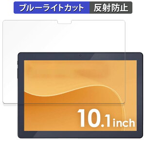 y|Cg2{z ACXI[} LUCA Tablet 10C` TM103M4V1-B  یtB u[CgJbg tB y˒ጸz {