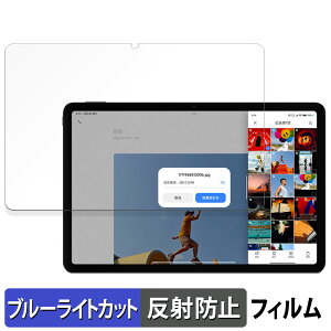 y|Cg2{z Xiaomi Redmi Pad Pro  یtB u[CgJbg tB y˒ጸz {