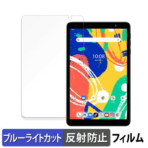 y|Cg2{z UMIDIGI G1 Tab Mini Kids  یtB u[CgJbg tB y˒ጸz {