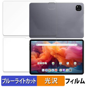 ALLDOCUBE iPlay 60 Pad Pro tEw Zbg  یtB u[CgJbg tB ydlz {